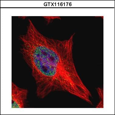 IHC-plus™ TDP2 / TTRAP Antibody
