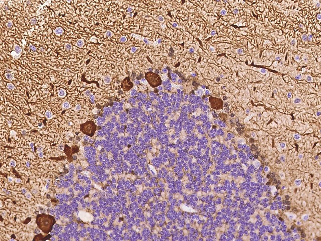 PPP1R1B / DARPP-32 Antibody