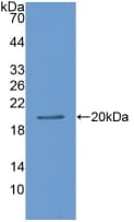 Leptin Antibody (aa22-167)