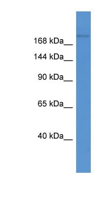 ABCA1 Antibody (aa1271-1320)