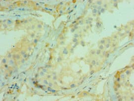 Polyclonal Rabbit anti-Human CDC5 / CDC5L Antibody (aa563-802, IHC)