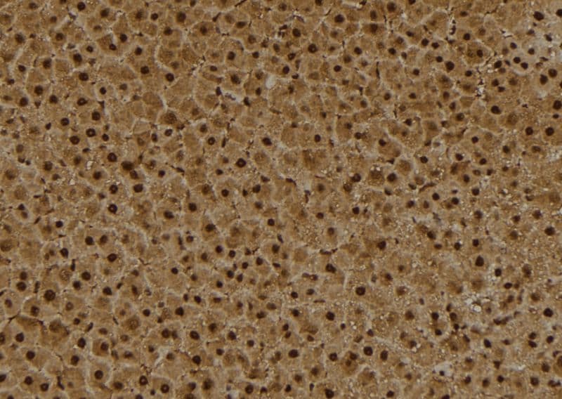 BCL6 Antibody