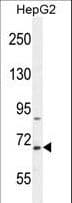 Polyclonal Rabbit anti-Human BUD13 Antibody (aa462-490, IHC, WB)