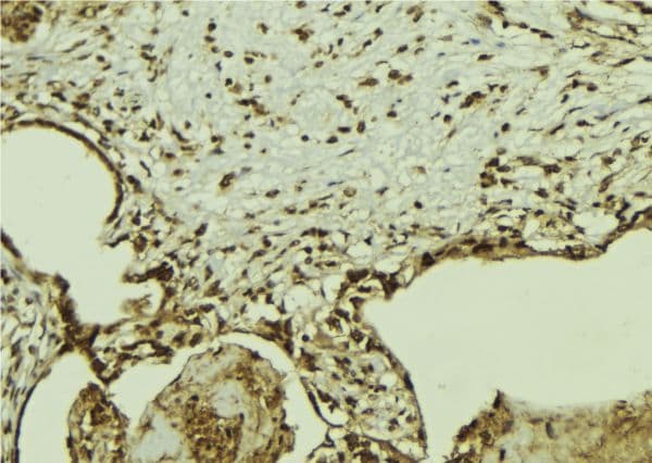 G3BP1 / G3BP Antibody