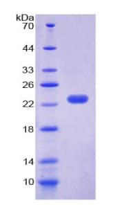Human CIRP / CIRBP Protein (Recombinant His-T7)