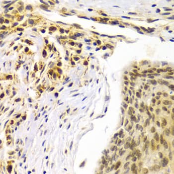 SMARCE1 / BAF57 Antibody