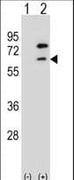 ZBTB7B / HcKrox Antibody (aa315-343)