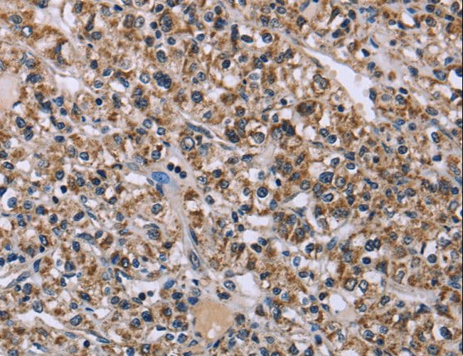 Polyclonal Rabbit anti-Human KCNJ11 / Kir6.2 Antibody (IHC)