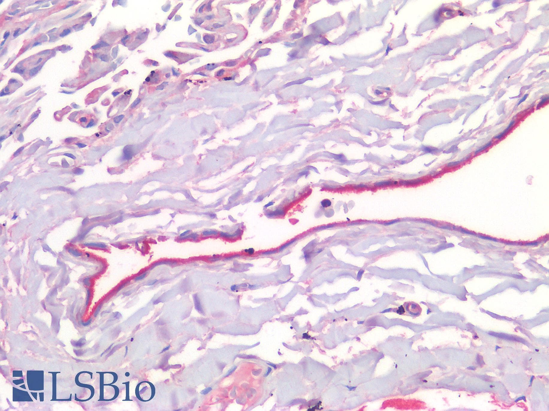IHC-plus™ MSLN / Mesothelin Antibody