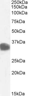 IHC-plus™ CBR / CBR1 Antibody (aa265-277)