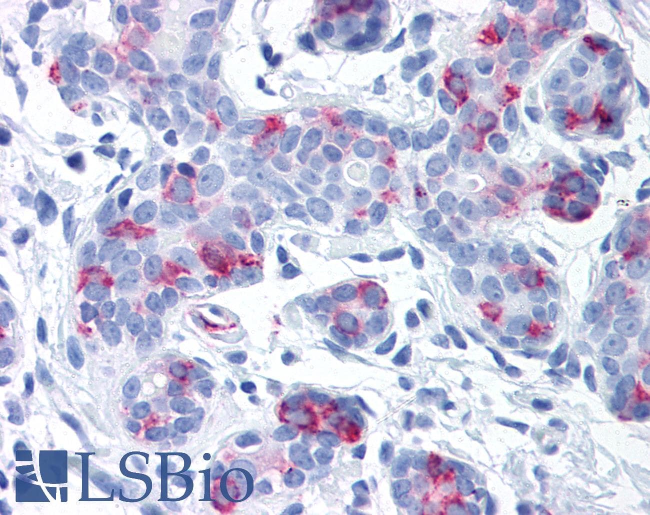 IHC-plus™ Polyclonal Rabbit anti-Human WNT8A Antibody (Internal, IHC)