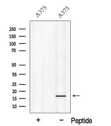 NOLA2 Antibody