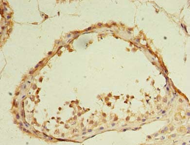 DDX31 Antibody