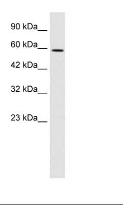Polyclonal Rabbit anti-Human TBX4 Antibody (aa257-306, WB)