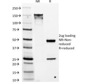 Monoclonal Mouse anti-Human ANO1 / DOG1 / TMEM16A Antibody (clone DG1/1486, Azide-free,BSA-free, IHC)