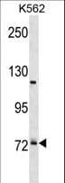 PRPF39 Antibody (aa591-620)