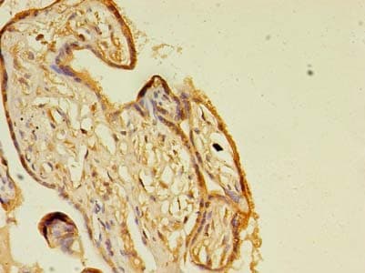 GH2 Antibody