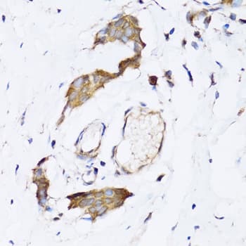 NAA10 / ARD1A Antibody