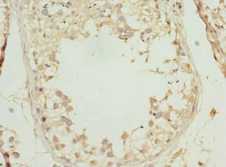 Polyclonal Rabbit anti-Human PRICKLE2 Antibody (IHC)