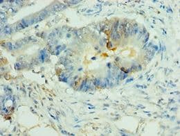 NLRP2 / NALP2 Antibody (aa1-220)