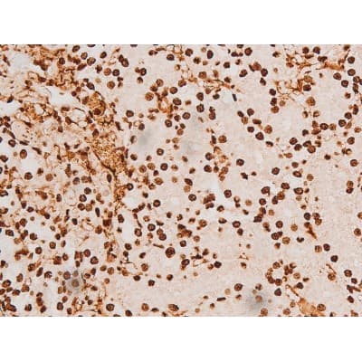 REL / C-Rel Antibody (phospho-Ser503)