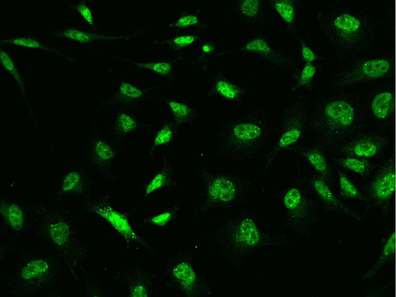 MORC1 Antibody