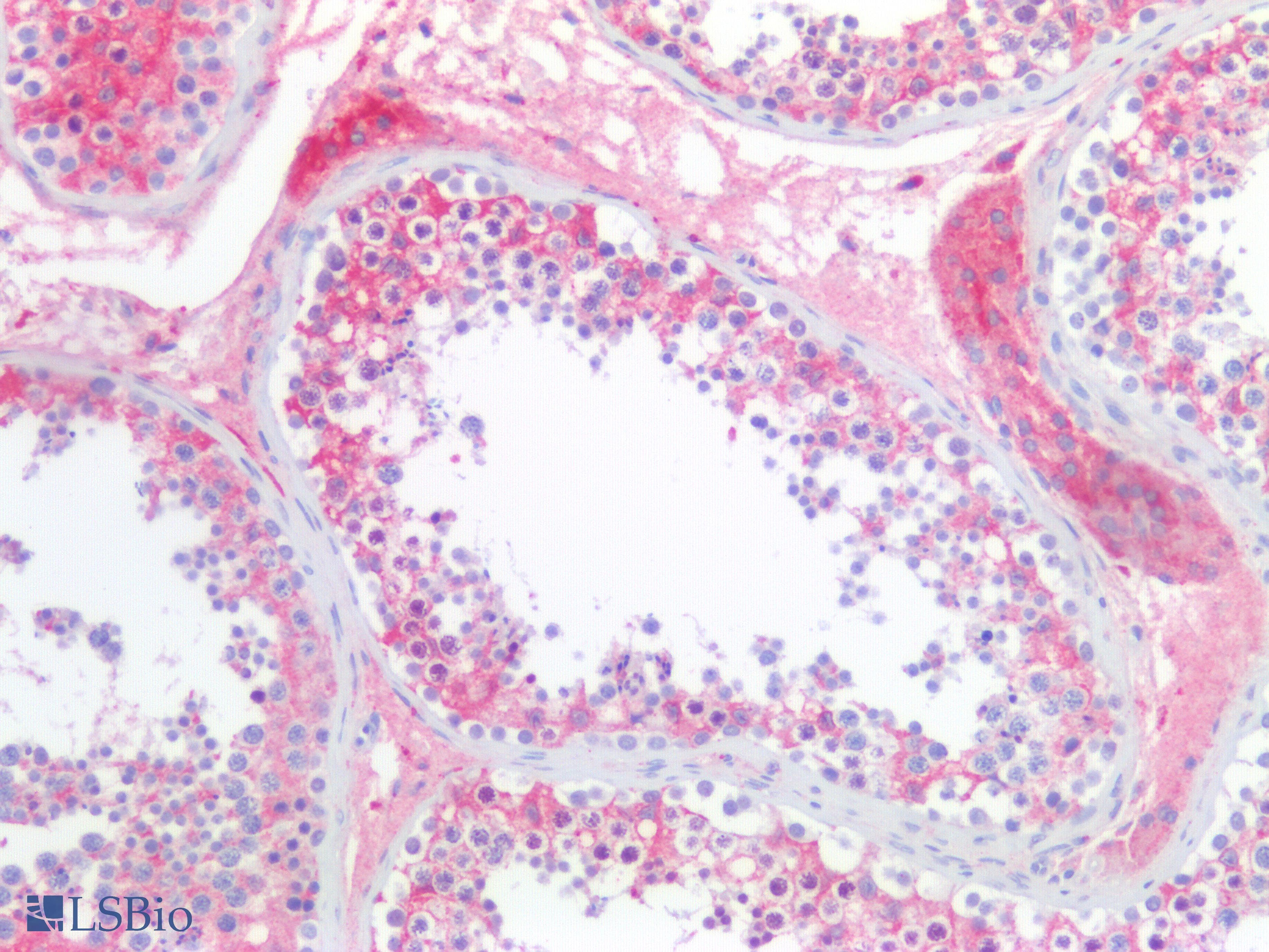 IHC-plus™ Polyclonal Rabbit anti-Human CHGA / Chromogranin A Antibody (Internal, IHC, WB)