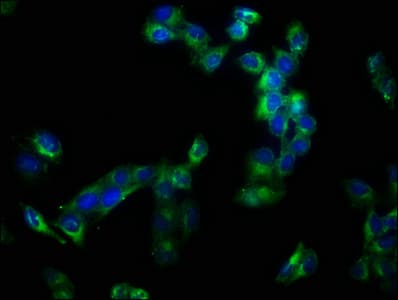 Polyclonal Rabbit anti-Human ADAM10 Antibody (IHC)