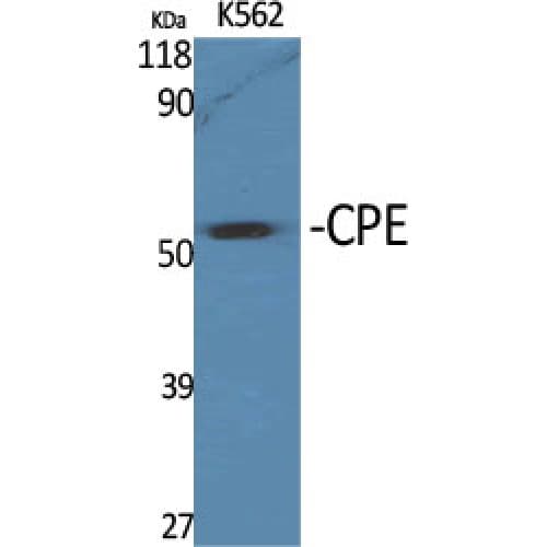 Polyclonal Rabbit anti-Human CPE / Carboxypeptidase E Antibody (240-320 aa, Internal, WB)