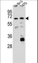 Polyclonal Rabbit anti-Human CES4A Antibody (aa533-561, IHC, WB)
