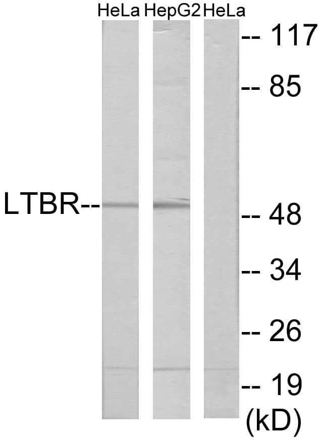 LTBR Antibody (aa11-60)