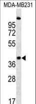 RCD1 / RQCD1 Antibody (aa106-134)