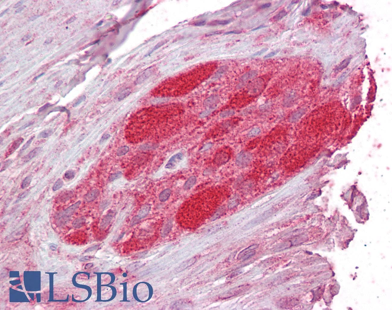 IHC-plus™ STUB1 / CHIP Antibody (aa219-231)