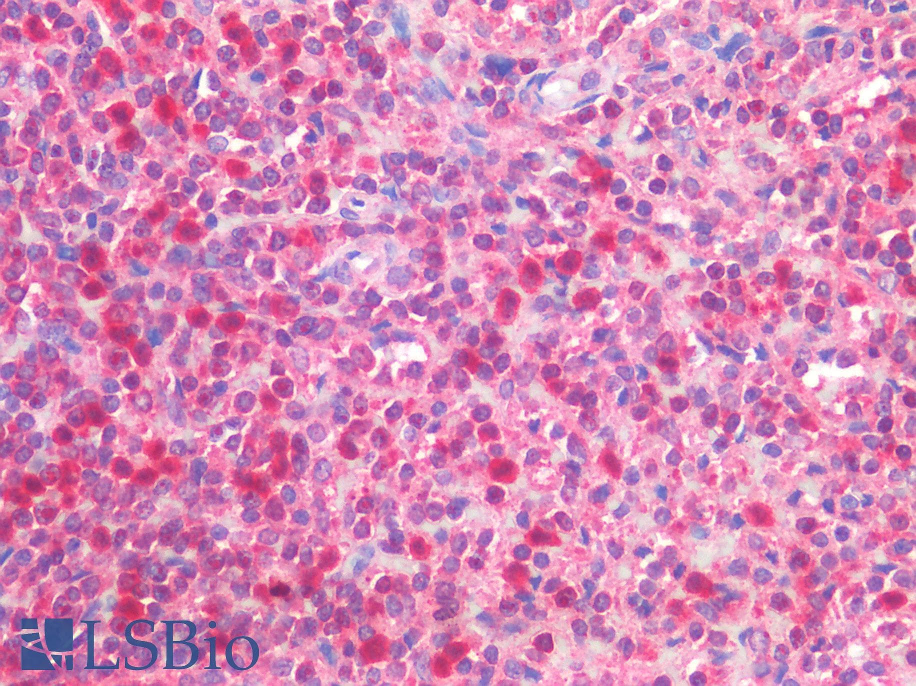 IHC-plus™ TNFSF4 / OX40L / CD252 Antibody