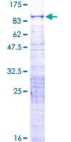 Human GLTSCR2 Protein (Recombinant GST)