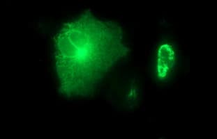 MMP13 Antibody (aa104-471, clone OTI3H3)