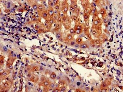 Polyclonal Rabbit anti-Human ARHGAP25 Antibody (IHC)