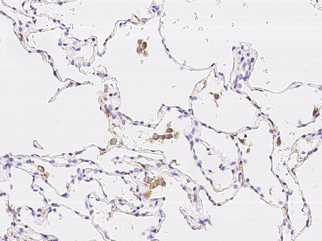 LAIR1 / CD305 Antibody