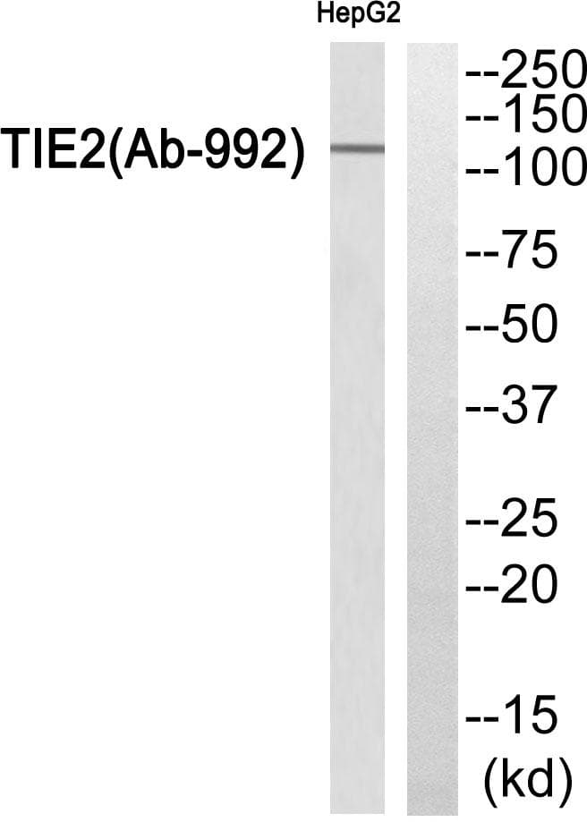 Polyclonal Rabbit anti-Human TEK / TIE2 Antibody (Ab-992, WB)