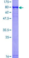 Human AKT1 Protein (Recombinant GST)