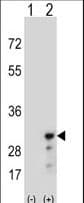 PRDX3 / Peroxiredoxin 3 Antibody (aa66-94)