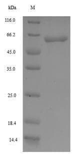 Human SHFM3 / FBXW4 Protein (Recombinant 6His-SUMO, N-terminus)