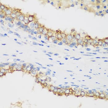 PTEN Antibody