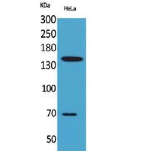 GP1BA / CD42b Antibody (261-310 aa, Internal)