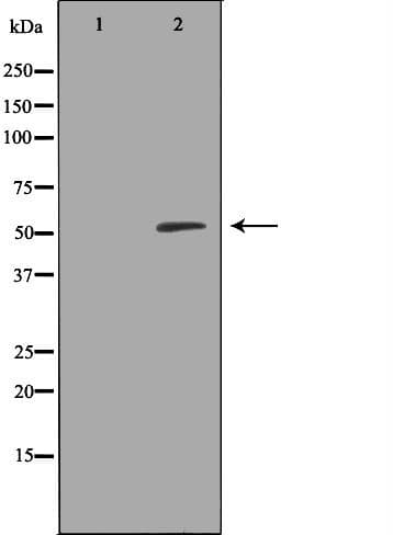 RALDH2 / ALDH1A2 Antibody