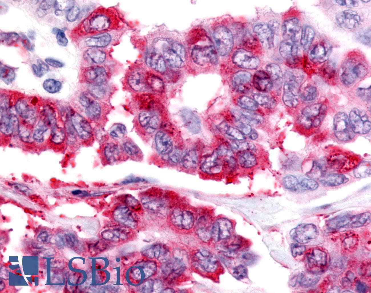 PathPlus™ Nor-1 / NR4A3 Antibody (Internal)