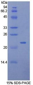 Rat LCN2 / Lipocalin 2 / NGAL Protein (Recombinant His)
