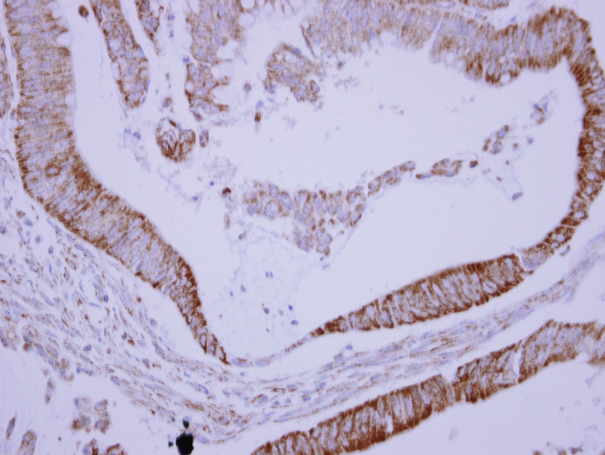 SH3BP5 / SAB Antibody