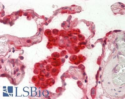 ASAH1 / Acid Ceramidase Antibody (aa287-336)