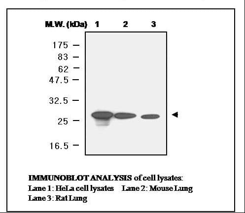 IHC-plus™ Monoclonal Mouse anti-Human PRDX6 / Peroxiredoxin 6 Antibody (clone 4A3, IHC, WB)